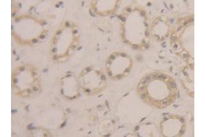 Image no. 2 for anti-Bleomycin Hydrolase (BLMH) (AA 213-447) antibody (ABIN1175598)