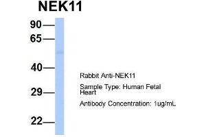 Image no. 1 for anti-NIMA (Never In Mitosis Gene A)-Related Kinase 11 (NEK11) (Middle Region) antibody (ABIN2783561)