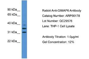 Image no. 2 for anti-GTPase, IMAP Family Member 6 (GIMAP6) (C-Term) antibody (ABIN2786559)