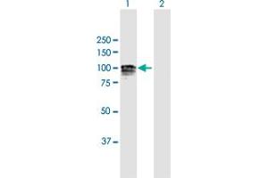 Image no. 2 for anti-Glucosidase, Alpha, Neutral AB (GANAB) (AA 1-944) antibody (ABIN950071)