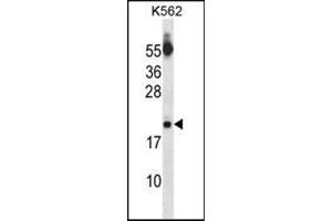 Image no. 1 for anti-Sin3A-Associated Protein, 18kDa (SAP18) (AA 57-86), (Middle Region) antibody (ABIN954669)