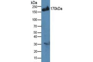 Image no. 1 for anti-Insulin Receptor Substrate 2 (IRS2) (AA 985-1255) antibody (ABIN5013744)