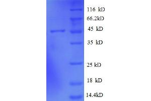Image no. 1 for ADP-Ribosylation Factor-Like 2 Binding Protein (ARL2BP) (AA 1-163), (full length) protein (GST tag) (ABIN1608035)
