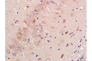 Image no. 2 for anti-Contactin 3 (Plasmacytoma Associated) (CNTN3) (AA 310-360) antibody (ABIN761441)