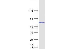 Image no. 1 for NOP2/Sun Domain Family, Member 6 (NSUN6) protein (Myc-DYKDDDDK Tag) (ABIN2727655)