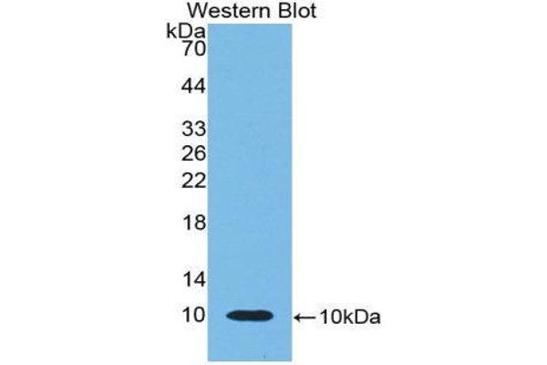 anti-beta-Thromboglobulin (beta-TG) (AA 46-107) antibody