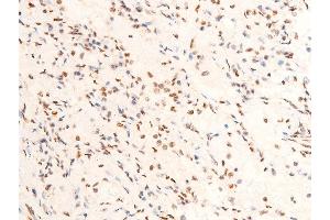 Image no. 3 for anti-Jun Proto-Oncogene (JUN) (pThr239) antibody (ABIN6255640)