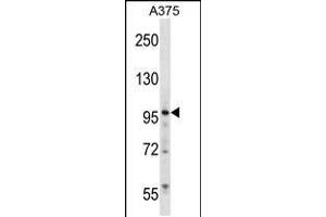Image no. 1 for anti-Zinc Finger Protein 541 (ZNF541) (AA 737-765) antibody (ABIN5532468)