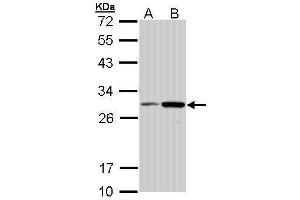 Image no. 3 for anti-NAD(P)H Dehydrogenase, Quinone 1 (NQO1) (C-Term) antibody (ABIN2854666)