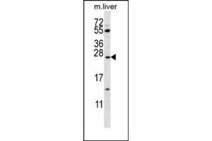 Image no. 2 for anti-Surfactant Protein C (SFTPC) (AA 1-30), (N-Term) antibody (ABIN954775)
