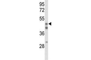Western blot analysis of HNF4A antibody and 293 lysate.