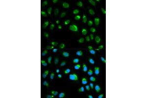 Image no. 2 for anti-Toll-Like Receptor 1 (TLR1) antibody (ABIN3023655)
