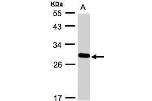 Image no. 1 for anti-Yip1 Domain Family, Member 4 (YIPF4) (Center) antibody (ABIN2856418)