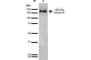 Image no. 2 for anti-Ankyrin 1, Erythrocytic (ANK1) (AA 1-1881) antibody (HRP) (ABIN2485534)