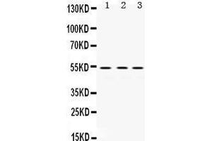 Image no. 1 for anti-Matrix Metallopeptidase 1 (Interstitial Collagenase) (MMP1) (AA 194-231), (Middle Region) antibody (ABIN3043405)