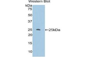 Image no. 1 for anti-Protein Kinase C, zeta (PRKCZ) (AA 404-591) antibody (ABIN1860239)