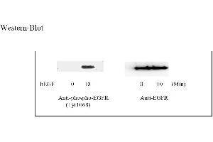Image no. 3 for Epidermal Growth Factor Receptor (EGFR) ELISA Kit (ABIN625223)