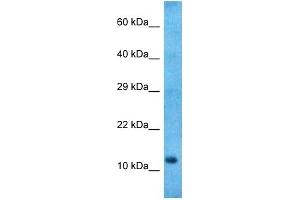 Image no. 1 for anti-Neuromedin B (N-Term) antibody (ABIN5517222)