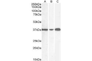 Image no. 13 for anti-Glyceraldehyde-3-Phosphate Dehydrogenase (GAPDH) (C-Term) antibody (ABIN185240)