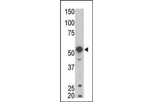 Image no. 1 for anti-B Lymphoid Tyrosine Kinase (BLK) (AA 1-30), (N-Term) antibody (ABIN392087)