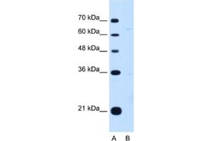 Image no. 1 for anti-Downstream Neighbor of SON (DONSON) antibody (ABIN2462908)