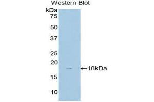Image no. 1 for anti-TAF13 RNA Polymerase II, TATA Box Binding Protein (TBP)-Associated Factor, 18kDa (TAF13) (AA 1-124) antibody (ABIN1860676)