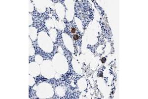 Image no. 1 for anti-Triggering Receptor Expressed On Myeloid Cells-Like 1 (TREML1) antibody (ABIN5590121)