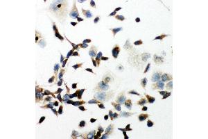 Image no. 1 for anti-VEGF Receptor 2 (VEGFR2) (AA 454-469), (Middle Region) antibody (ABIN3044301)