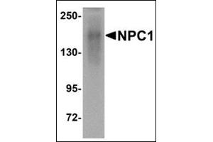 Image no. 2 for anti-Niemann-Pick Disease, Type C1 (NPC1) (C-Term) antibody (ABIN500383)