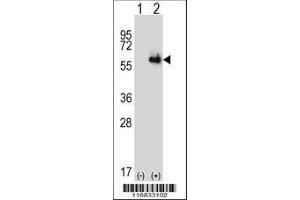 Image no. 3 for anti-Aldehyde Dehydrogenase 4 Family, Member A1 (ALDH4A1) (AA 288-314) antibody (ABIN392357)