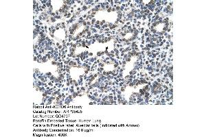 KCTD6 Antikörper  (N-Term)