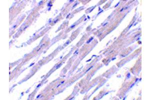 Image no. 3 for anti-BCL2-Like 13 (Apoptosis Facilitator) (BCL2L13) (Internal Region) antibody (ABIN6656933)