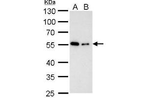Image no. 2 for anti-alpha Tubulin (TUBA1) (Center) antibody (ABIN2855283)