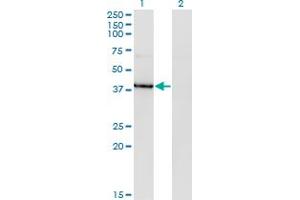 Image no. 2 for anti-Histone Deacetylase 8 (HDAC8) (AA 1-100) antibody (ABIN527748)