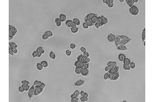 Image no. 1 for Pertussis Toxin (ARTC) (Active) protein (ABIN2452202)