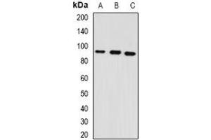 Image no. 1 for anti-Glycerol-3-Phosphate Acyltransferase, Mitochondrial (GPAM) (full length) antibody (ABIN6004674)