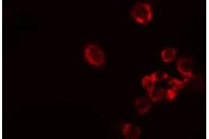 Image no. 1 for anti-V-Raf Murine Sarcoma 3611 Viral Oncogene Homolog (ARAF) (Internal Region) antibody (ABIN6259664)