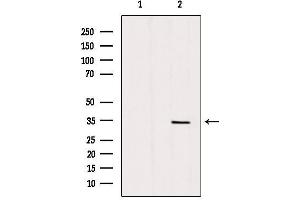 Image no. 1 for anti-Solute Carrier Family 25 (Mitochondrial Carrier, Adenine Nucleotide Translocator), Member 5 (SLC25A5) antibody (ABIN6265122)
