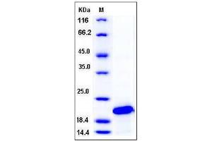 Image no. 1 for Superoxide Dismutase 1, Soluble (SOD1) (AA 2-154) protein (His tag) (ABIN2004728)