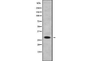 Image no. 1 for anti-Dehydrogenase/reductase (SDR Family) Member 11 (DHRS11) (Internal Region) antibody (ABIN6261289)