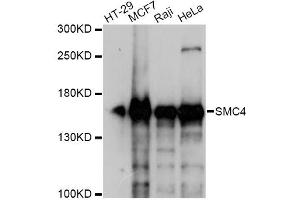 Image no. 1 for anti-Structural Maintenance of Chromosomes 4 (SMC4) antibody (ABIN6568210)