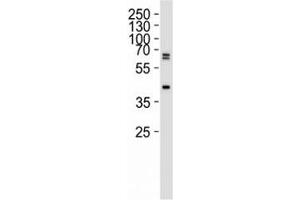 Image no. 5 for anti-SET Domain Containing (Lysine Methyltransferase) 8 (SETD8) (N-Term) antibody (ABIN3032551)