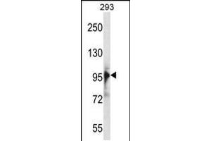 Image no. 1 for anti-RNA Binding Motif Protein 10 (RBM10) (AA 85-113), (N-Term) antibody (ABIN5533475)