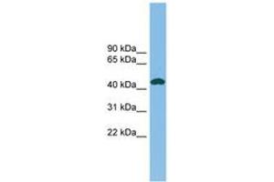Image no. 1 for anti-Nodal Homolog (NODAL) (C-Term) antibody (ABIN6745136)