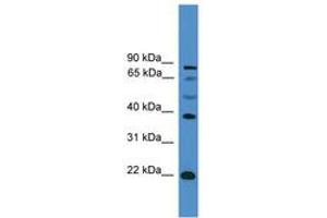 Image no. 1 for anti-Achaete-Scute Complex Homolog 2 (ASCL2) (AA 121-170) antibody (ABIN6745359)