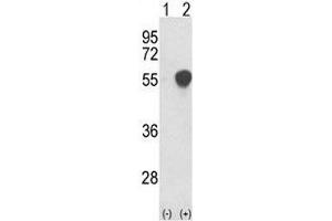 Image no. 4 for anti-phosphoglycerate Dehydrogenase (PHGDH) (AA 140-168) antibody (ABIN3032221)