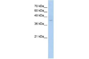 Image no. 2 for anti-Transmembrane Protein 8B (TMEM8B) (N-Term) antibody (ABIN2777055)