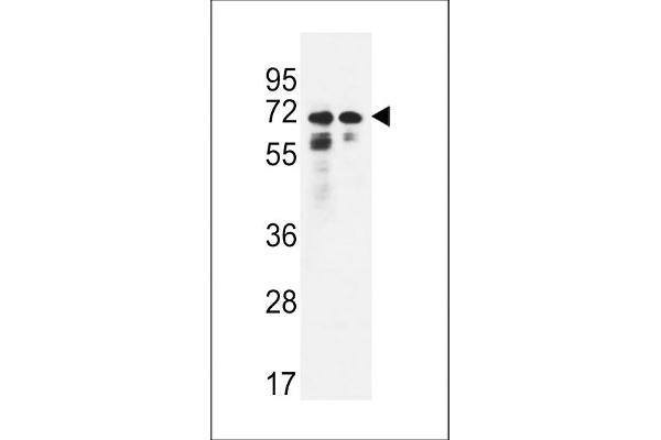 PNPLA8 Antikörper  (N-Term)
