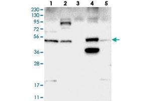 Image no. 2 for anti-Sorting Nexin Family Member 30 (SNX30) antibody (ABIN5588493)
