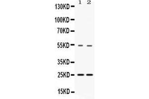 Image no. 1 for anti-Vesicle-Associated Membrane Protein 7 (VAMP7) (AA 24-190) antibody (ABIN4886758)